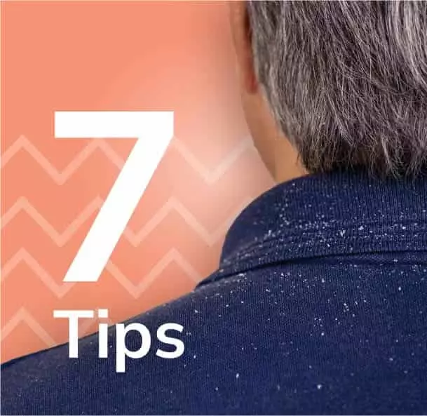 Home Remedies To Treat Dandruff